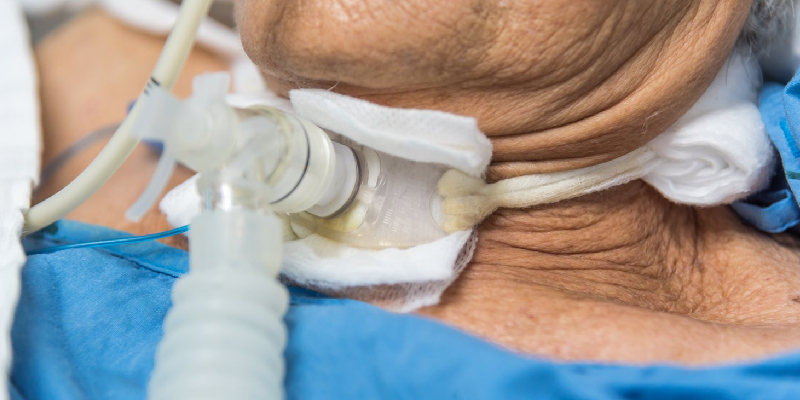 Tracheostomy Treatment in Thane by ENT Specialist