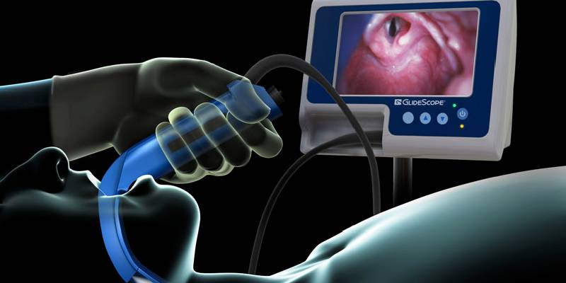 Videolaryngoscopy in Thane